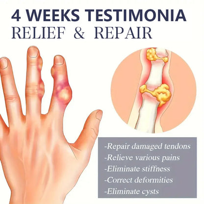 Crème articulaire au venin d'abeille